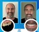 Slider image (10) Art Dental Care